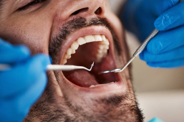 Best Emergency Treatment for Toothache in Mount Vernon, OH
