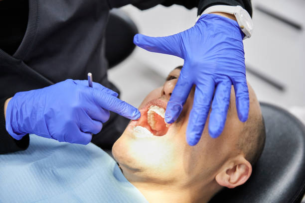 Best Emergency Broken Tooth Repair in Mount Vernon, OH